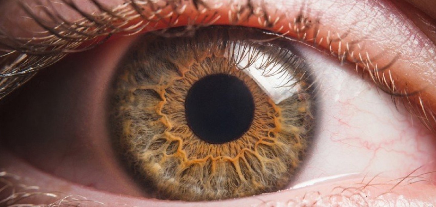 Myopia – novodobá epidémia